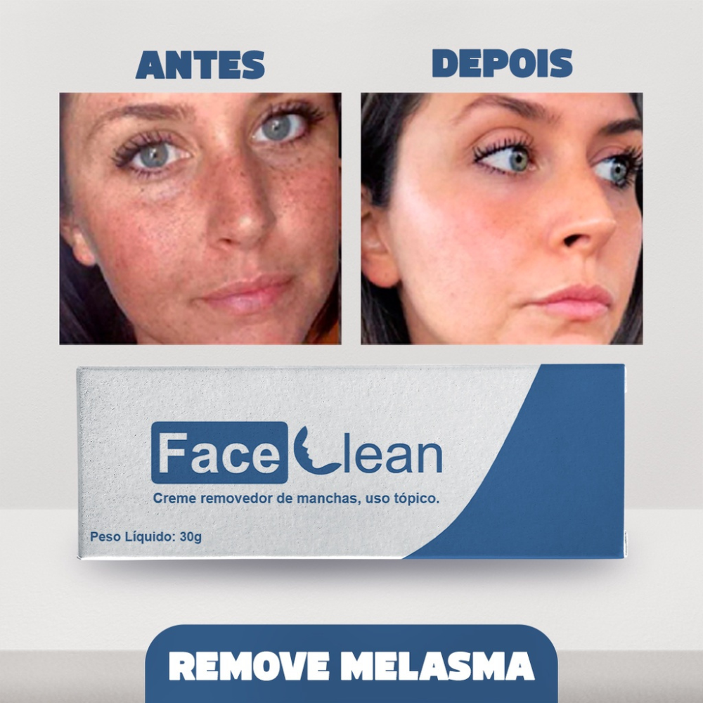 Cicatribem Oficial - Sua Pele Mais Saudável - Compre 1 Leve 2 + Frete Grátis